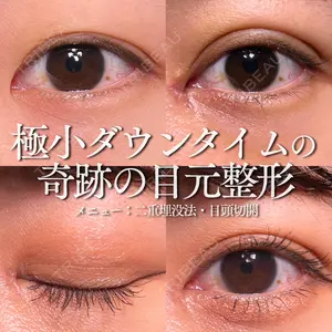 30 days after image