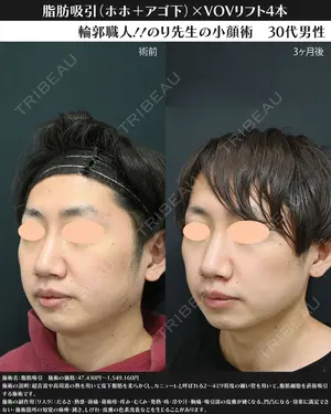 90 days after image