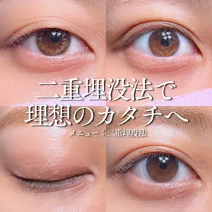 30 days after image