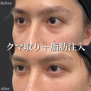before image