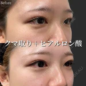 before image