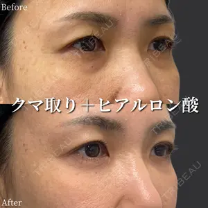 before image