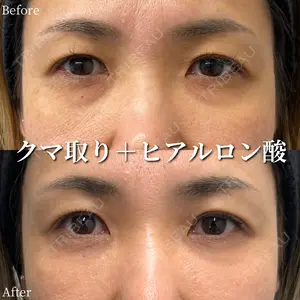 31 days after image