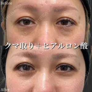 before image