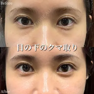before image
