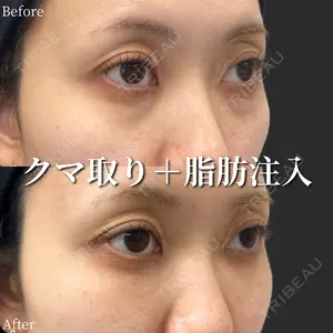 before image