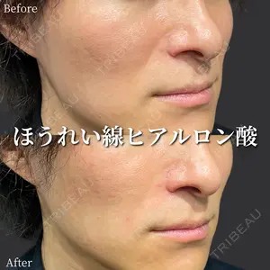 before image