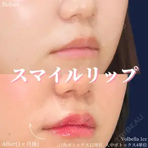 null days after image