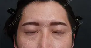 30 days after image