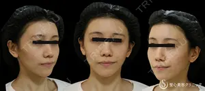 42 days after image