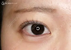 30 days after image