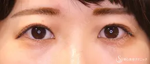 90 days after image