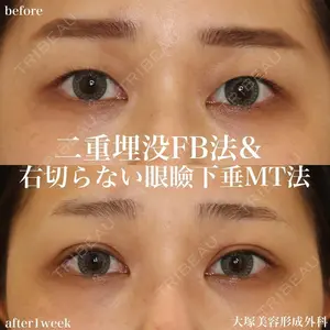 before image