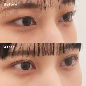 before image