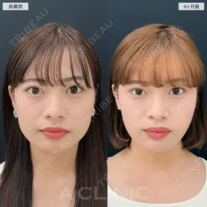 120 days after image