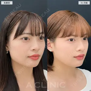 120 days after image