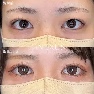 before image