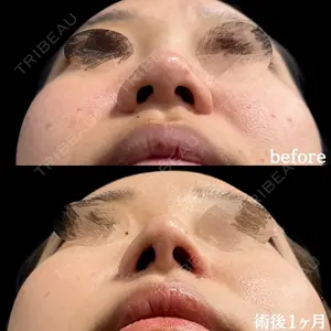 31 days after image