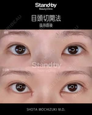 5 days after image