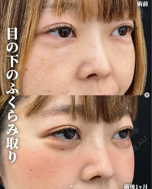 before image
