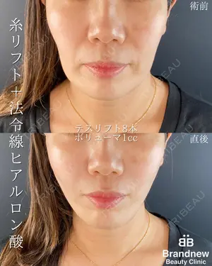 before image
