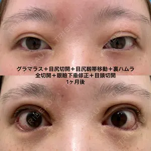 before image