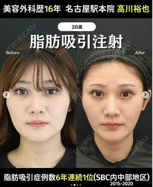 60 days after image