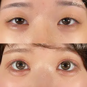 before image