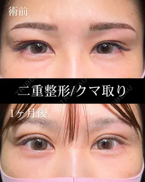 30 days after image