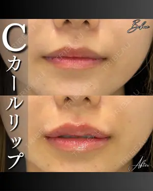 before image