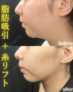 30 days after image
