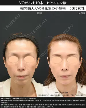 30 days after image