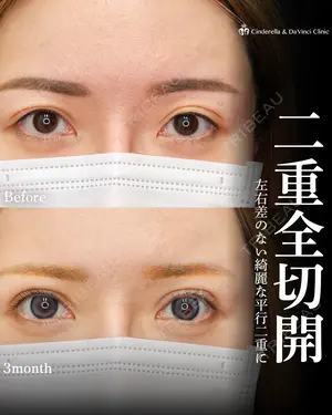 90 days after image