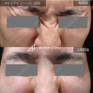 14 days after image