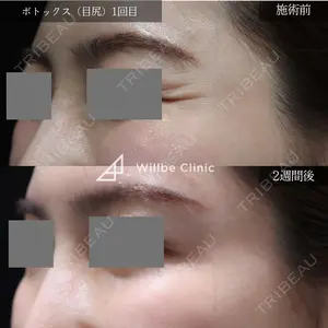 before image