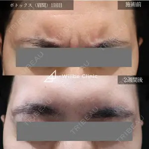 before image
