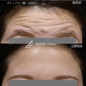 before image