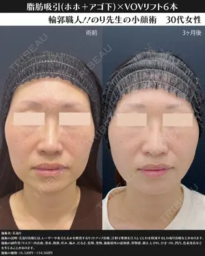 30 days after image