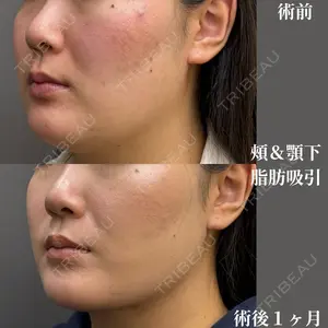 30 days after image