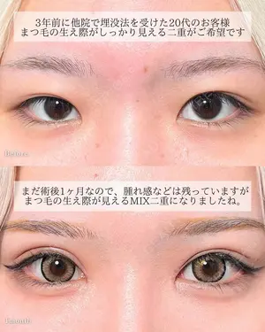 30 days after image