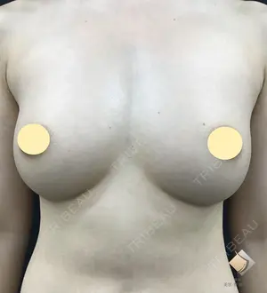 180 days after image