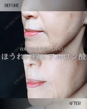 0 days after image