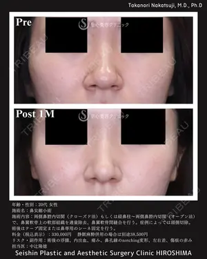 before image