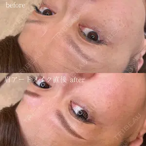 before image