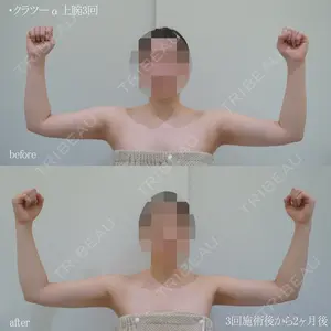 null days after image
