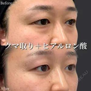 before image