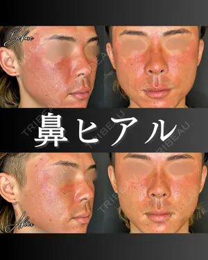 before image