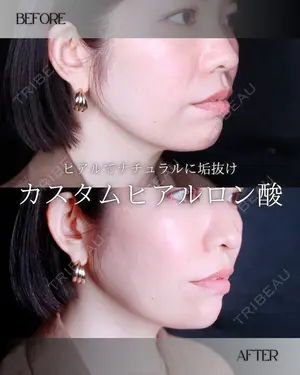 0 days after image