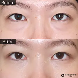 before image