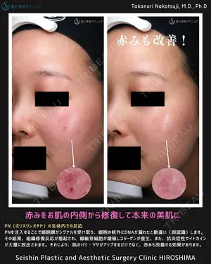 7 days after image